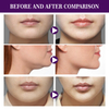 Face Lift Tape Lift Firming Face Double Chin Lift Tape V Face Melon Seed Face Invisible lift tape