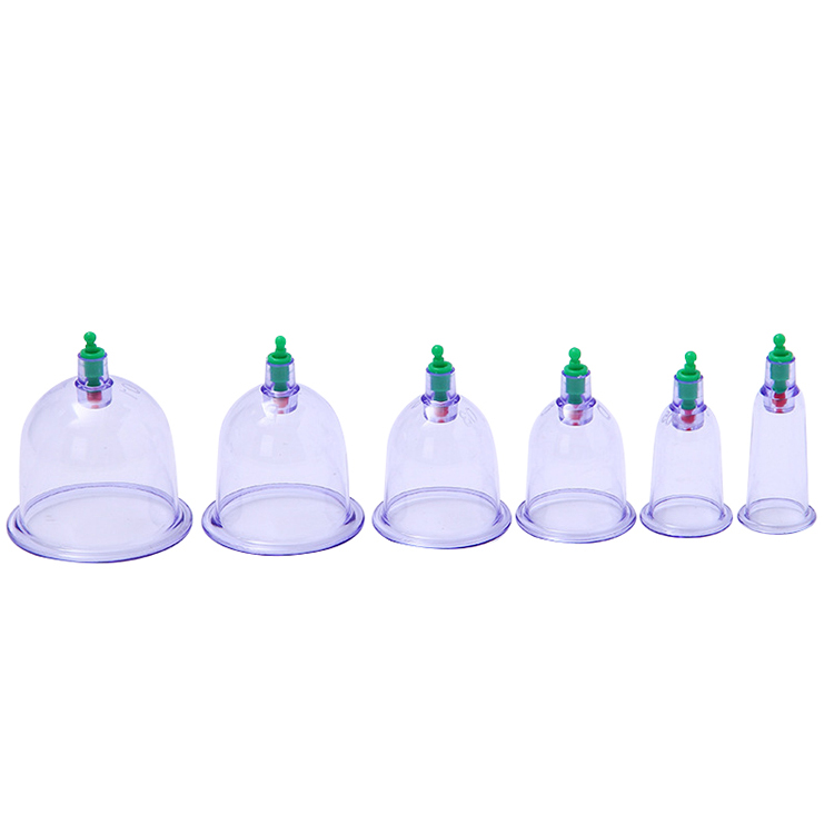 Shuangjin 6 Cups Cupping Set Professional Chinese Acupoint Cupping Treatment Set Health Massage Vacuum Cupping Cups