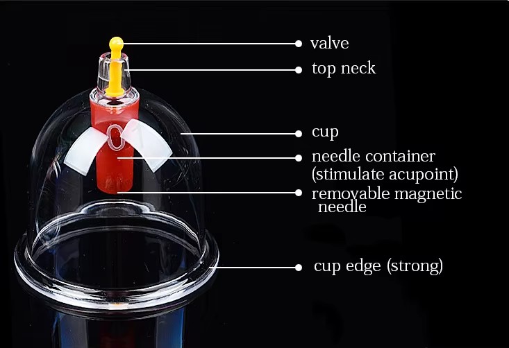 cupping2